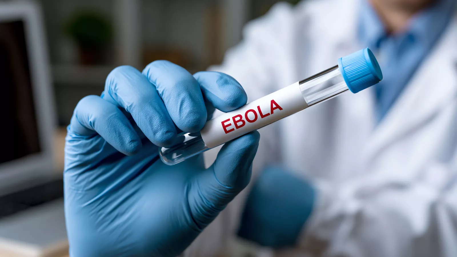 RDC : l’épidémie d’Ebola atteint 5 208 cas confirmés dans six provinces